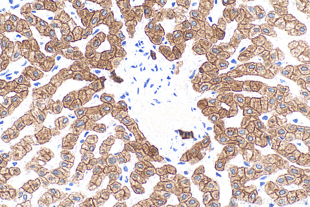 Immunohistochemistry (IHC) staining of human liver tissue using Cytokeratin 8 Polyclonal antibody (10384-1-AP)