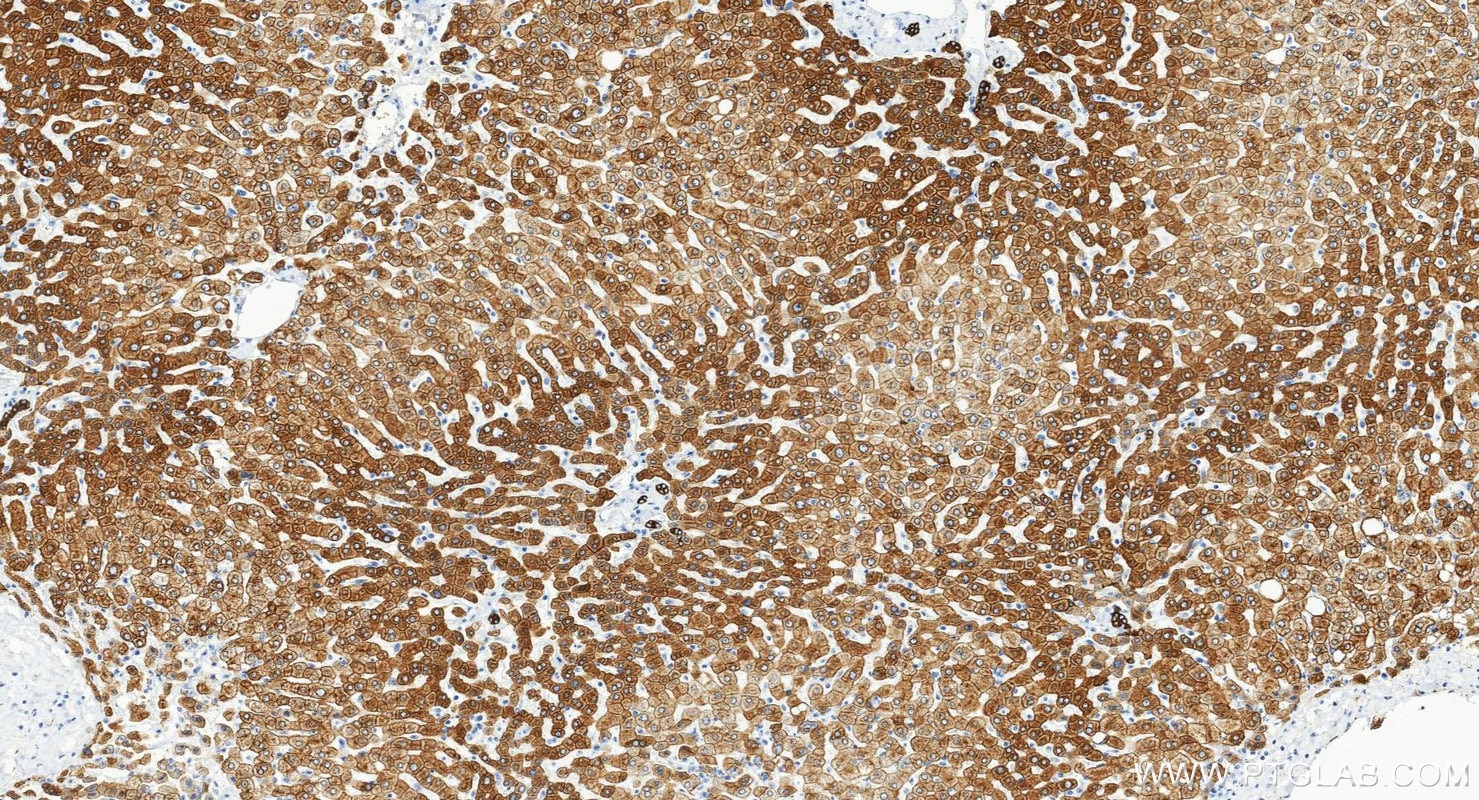Immunohistochemistry (IHC) staining of human liver tissue using Cytokeratin 8 Polyclonal antibody (10384-1-AP)