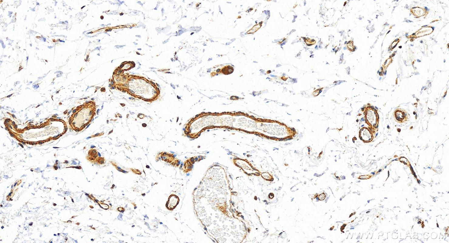 Immunohistochemistry (IHC) staining of human  colon using Cytokeratin 8 Polyclonal antibody (17514-1-AP)