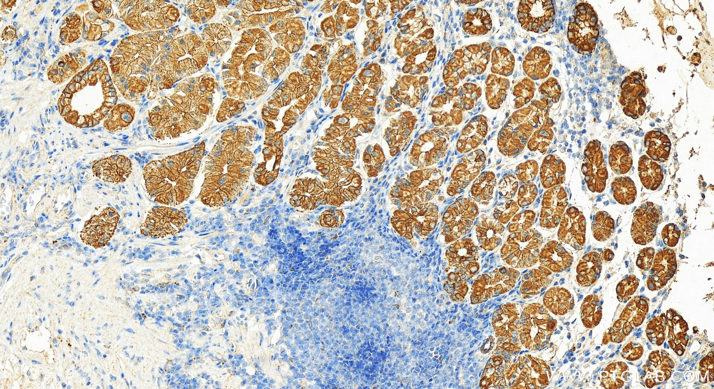 Immunohistochemistry (IHC) staining of human stomach tissue using Cytokeratin 8 Polyclonal antibody (17514-1-AP)