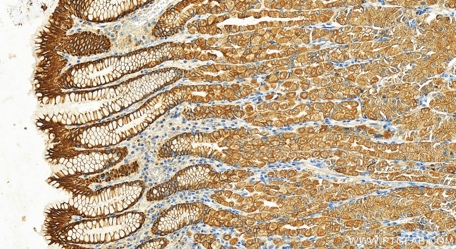 Immunohistochemistry (IHC) staining of human stomach tissue using Cytokeratin 8 Polyclonal antibody (17514-1-AP)