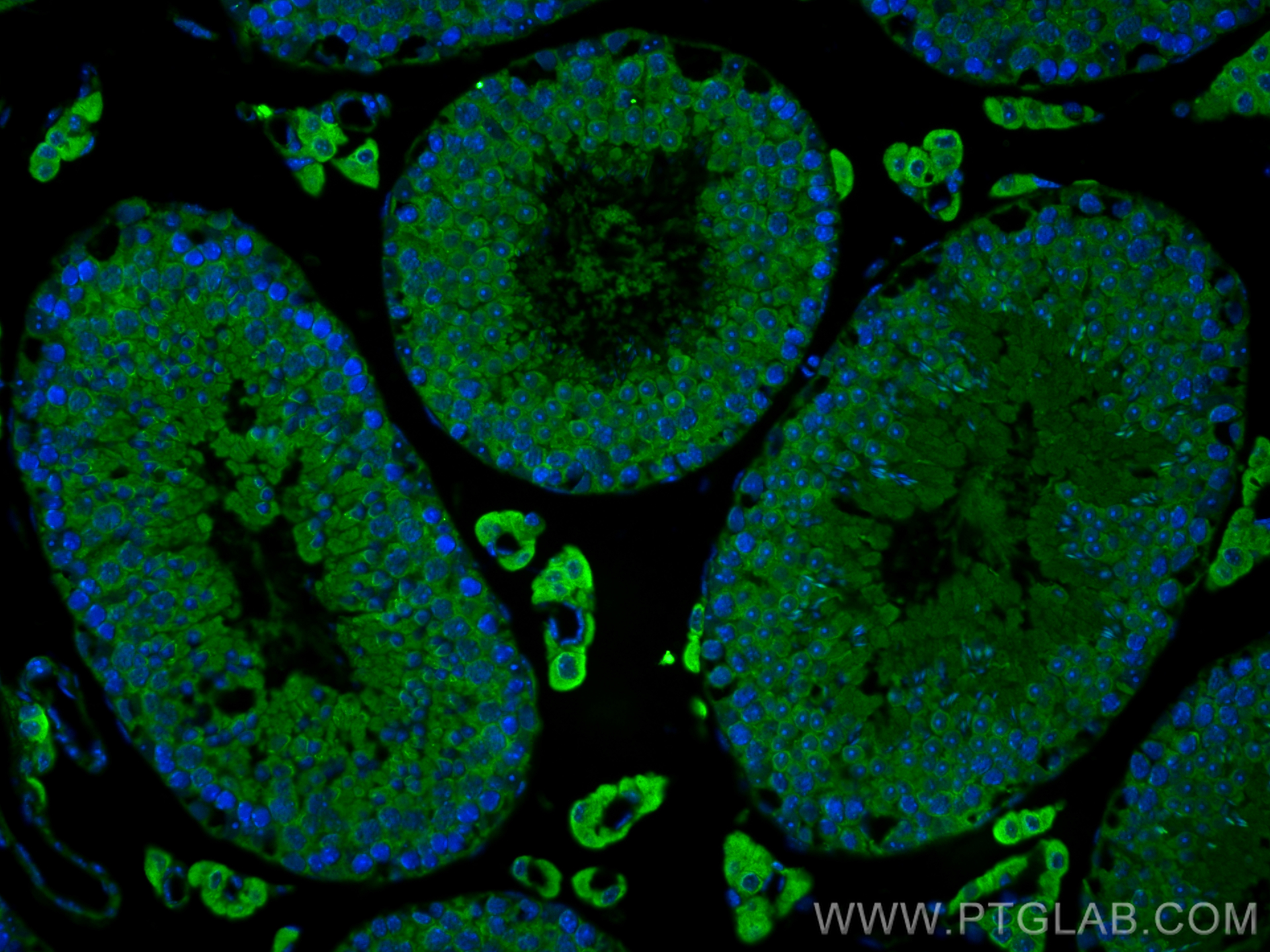 Immunofluorescence (IF) / fluorescent staining of mouse testis tissue using Cytokeratin 8 Polyclonal antibody (17514-1-AP)