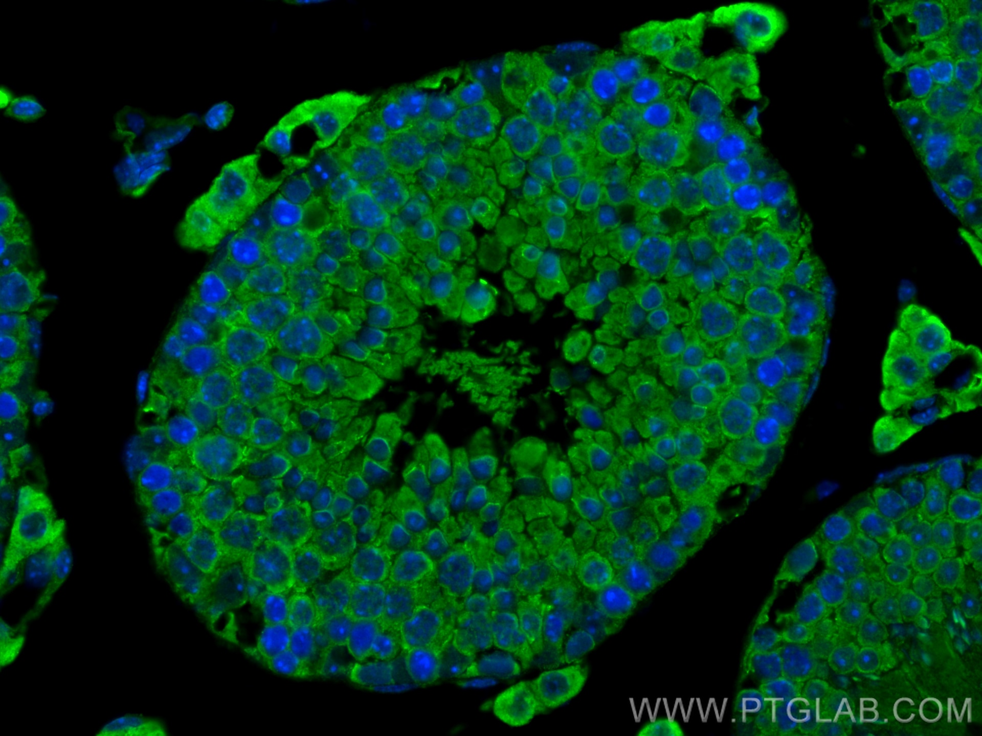 Immunofluorescence (IF) / fluorescent staining of mouse testis tissue using Cytokeratin 8 Polyclonal antibody (17514-1-AP)
