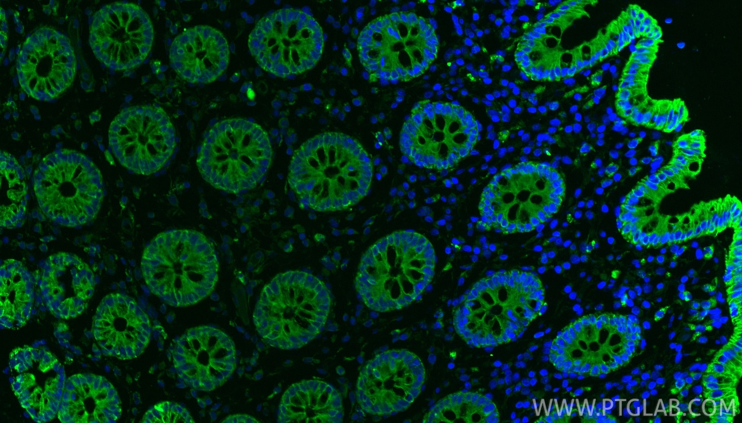 Immunofluorescence (IF) / fluorescent staining of human colon tissue using Cytokeratin 8 Polyclonal antibody (17514-1-AP)