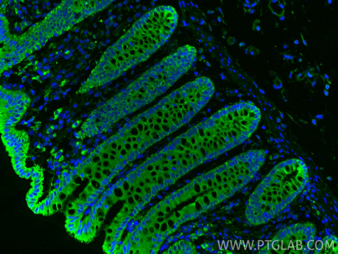Immunofluorescence (IF) / fluorescent staining of human colon tissue using Cytokeratin 8 Polyclonal antibody (17514-1-AP)