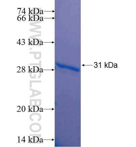 KRT86 fusion protein Ag22943 SDS-PAGE