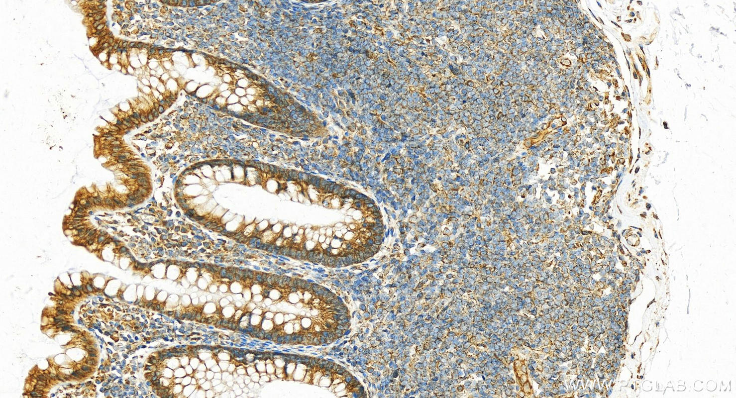 Immunohistochemistry (IHC) staining of human colon tissue using KTN1 Polyclonal antibody (19841-1-AP)