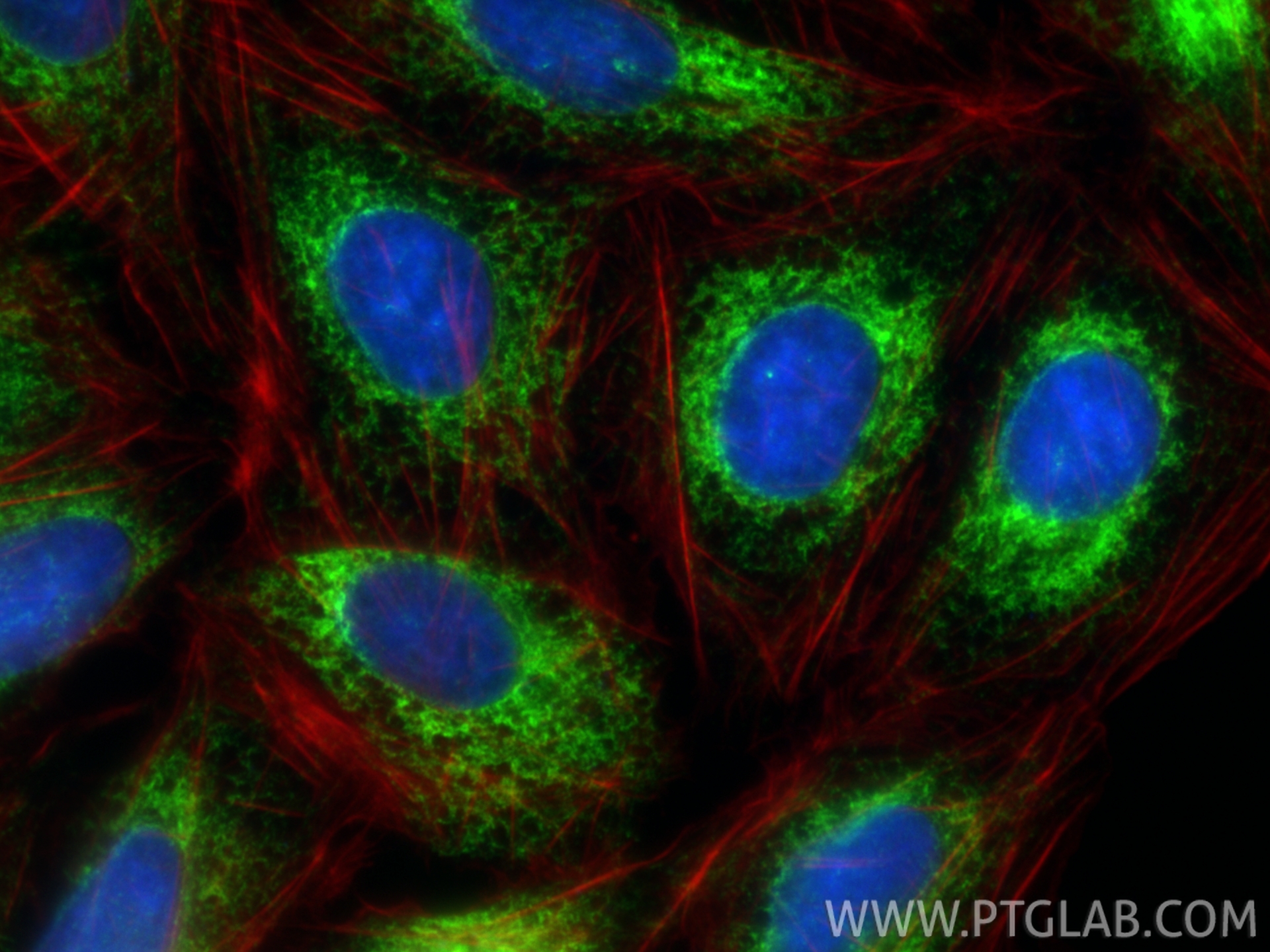 Immunofluorescence (IF) / fluorescent staining of U2OS cells using KTN1 Recombinant monoclonal antibody (85681-4-RR)