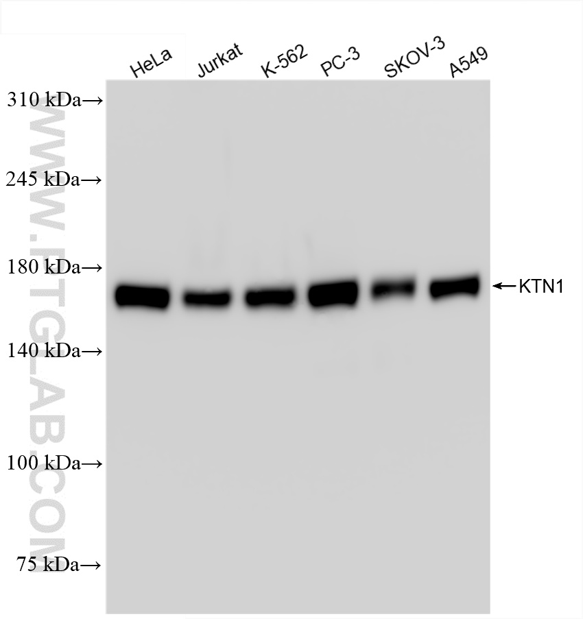 Western Blot (WB) analysis of various lysates using KTN1 Recombinant antibody (85681-4-RR)