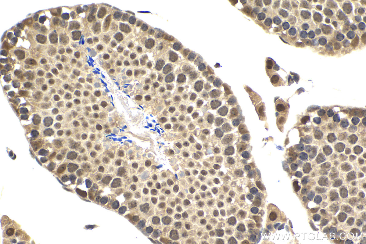 Immunohistochemistry (IHC) staining of mouse testis tissue using KU70,XRCC6 Polyclonal antibody (10723-1-AP)