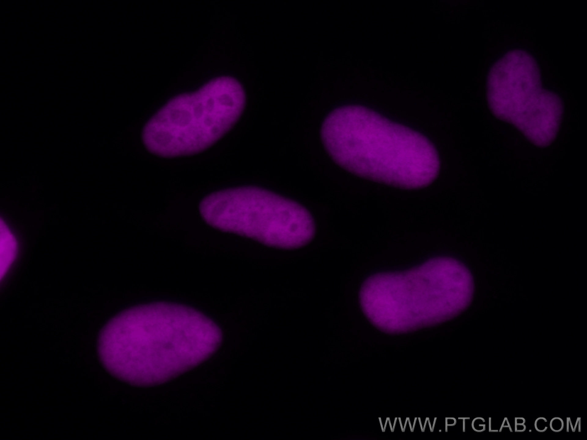 Immunofluorescence (IF) / fluorescent staining of HeLa cells using CoraLite® Plus 647-conjugated KU70 Polyclonal anti (CL647-10723)