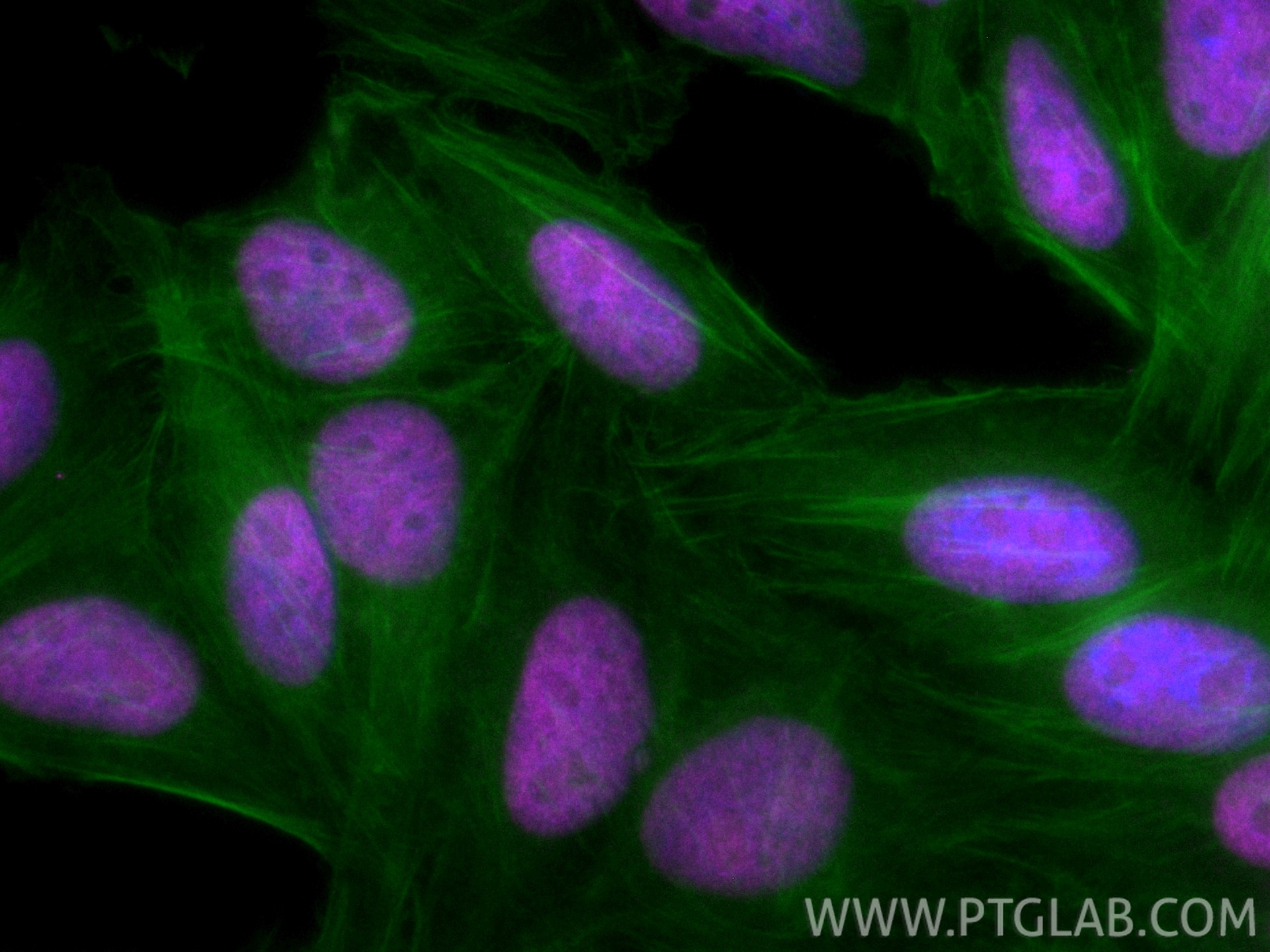 Immunofluorescence (IF) / fluorescent staining of HepG2 cells using CoraLite® Plus 647-conjugated KU70/XRCC6 Polyclona (CL647-10723)