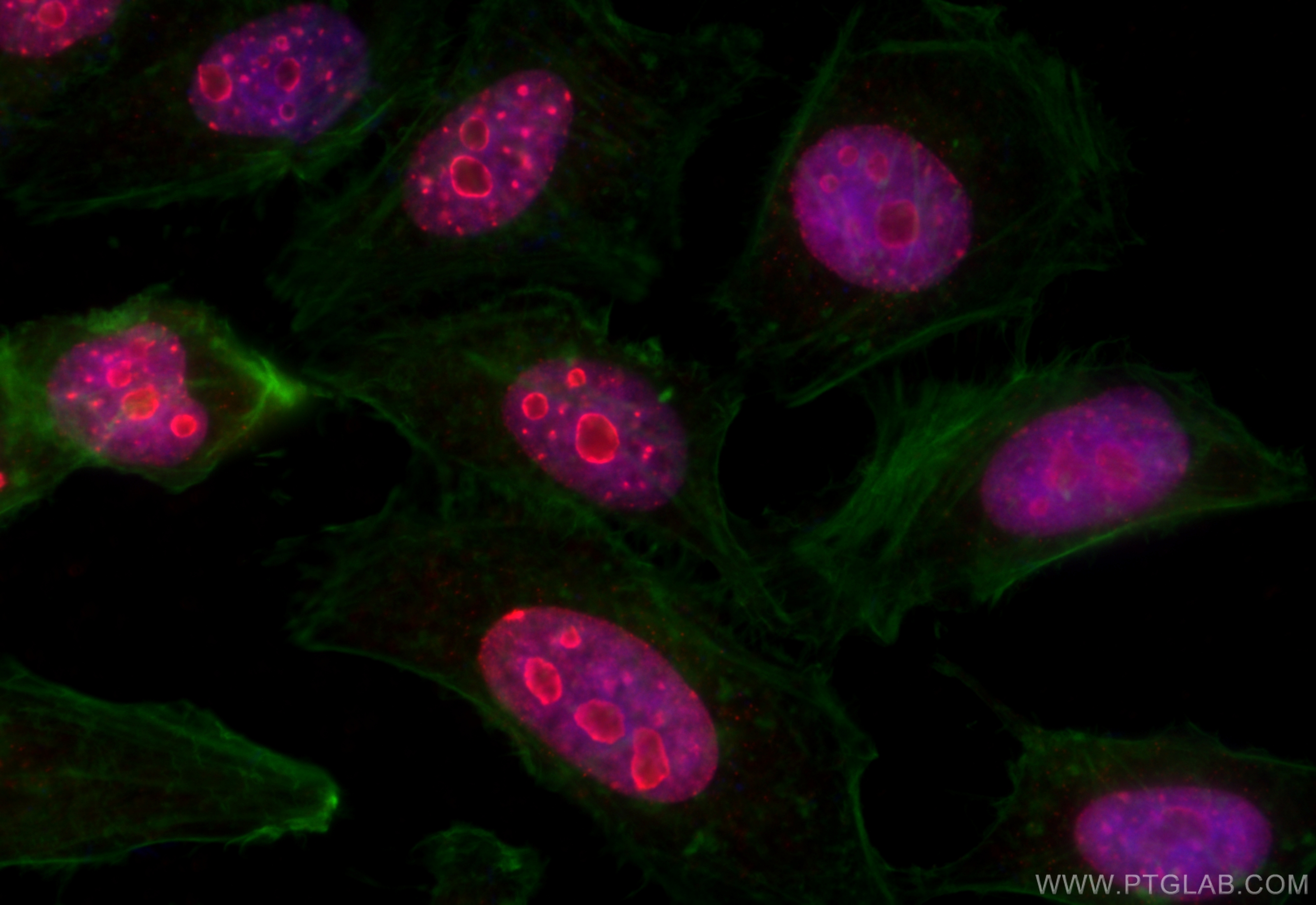 Immunofluorescence (IF) / fluorescent staining of HeLa cells using Ki-67 Polyclonal antibody (32270-1-AP)