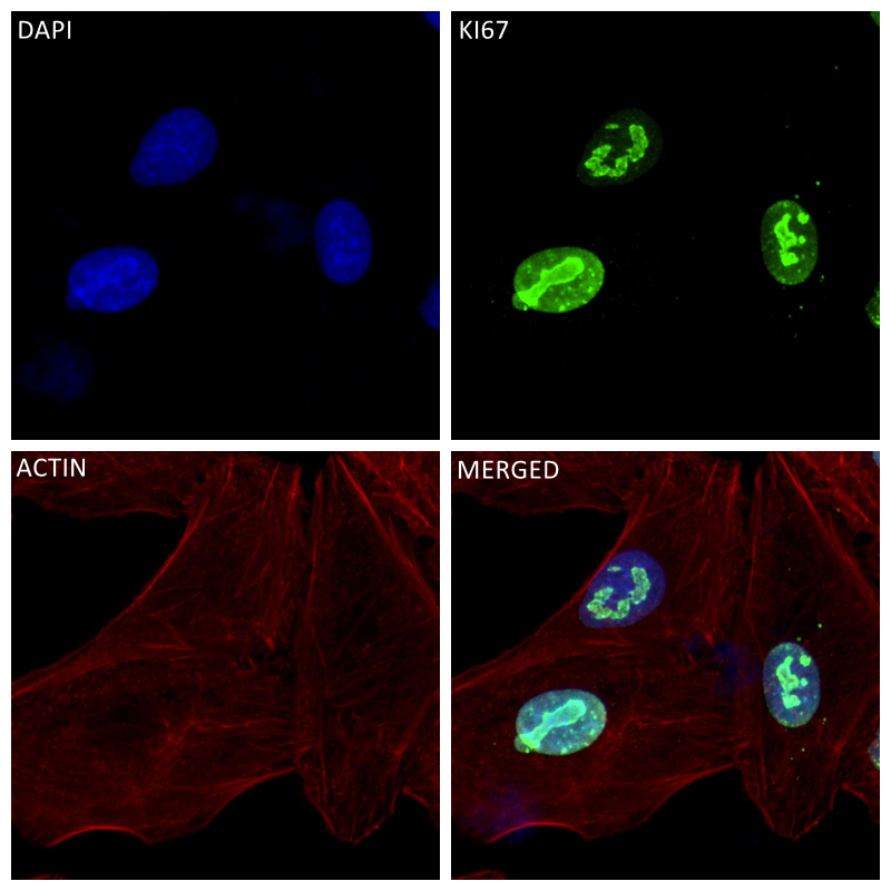 Immunofluorescence (IF) / fluorescent staining of A549 cells using Ki-67 Recombinant antibody (84192-4-RR)