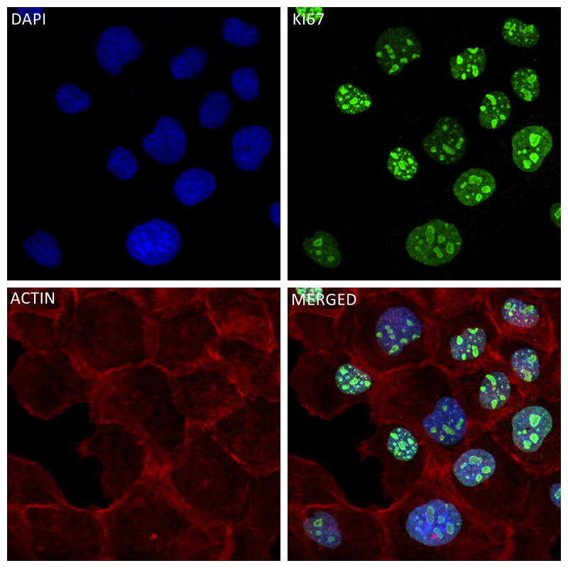 Immunofluorescence (IF) / fluorescent staining of A431 cells using Ki-67 Recombinant antibody (84192-4-RR)