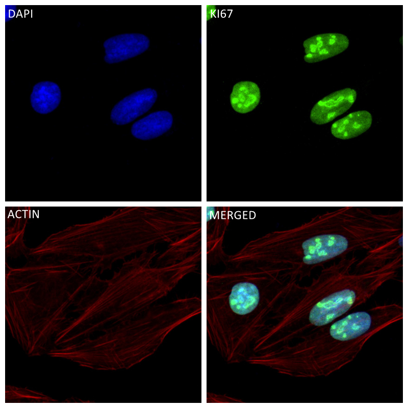 Immunofluorescence (IF) / fluorescent staining of U2OS cells using Ki-67 Recombinant antibody (84192-4-RR)