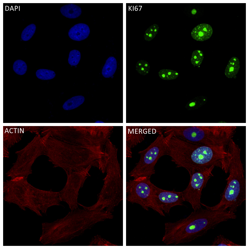 Immunofluorescence (IF) / fluorescent staining of MCF-7 cells using Ki-67 Recombinant antibody (84192-4-RR)