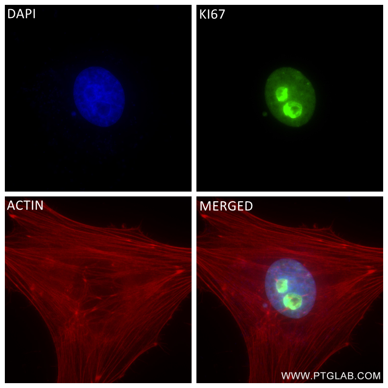 Immunofluorescence (IF) / fluorescent staining of HeLa cells using Ki-67 Recombinant antibody (84192-4-RR)