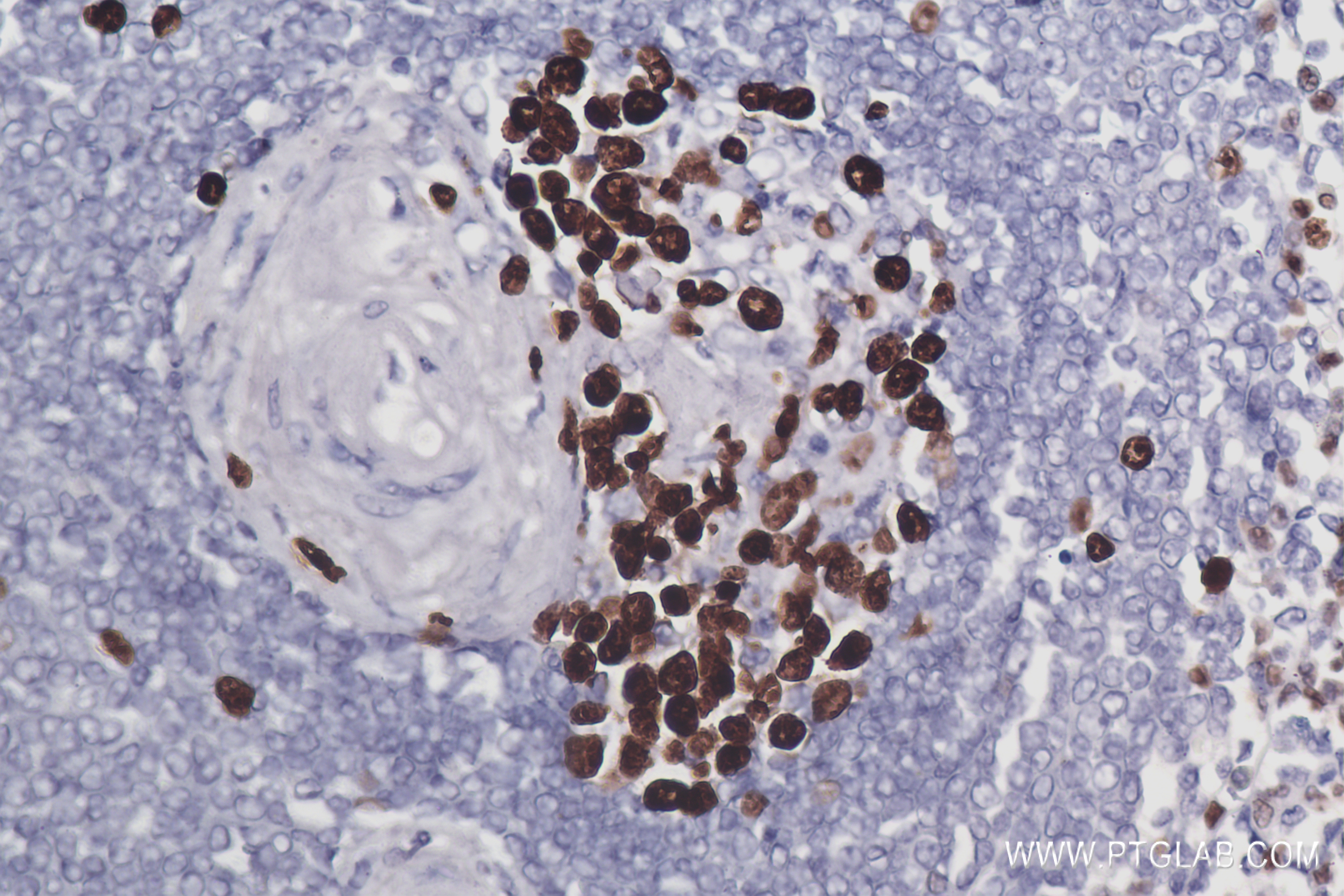 Immunohistochemistry (IHC) staining of Human Spleen tissue using Ki-67 Recombinant antibody (84192-4-RR)