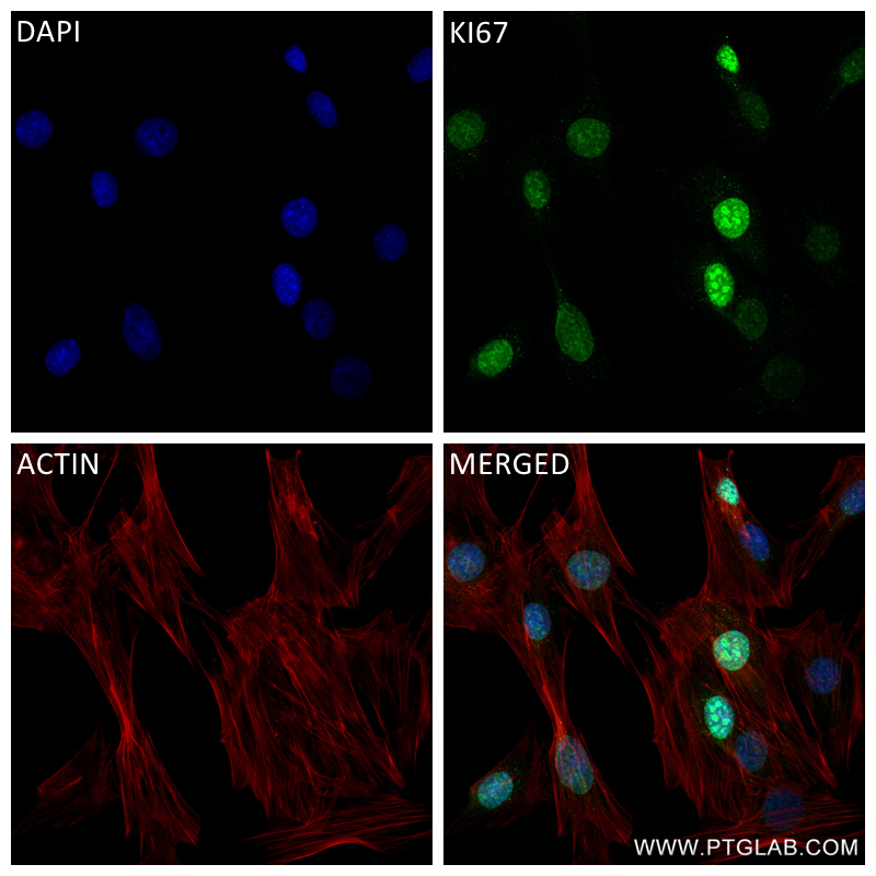 Immunofluorescence (IF) / fluorescent staining of C2C12 cells using Ki-67 Recombinant antibody (84432-1-RR)