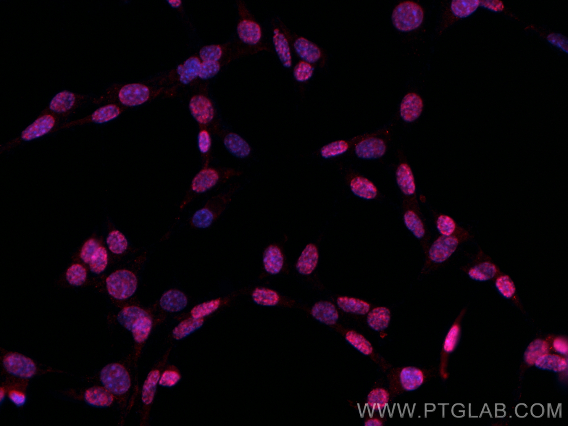 Immunofluorescence (IF) / fluorescent staining of NIH/3T3 cells using Ki-67 Recombinant antibody (84432-1-RR)