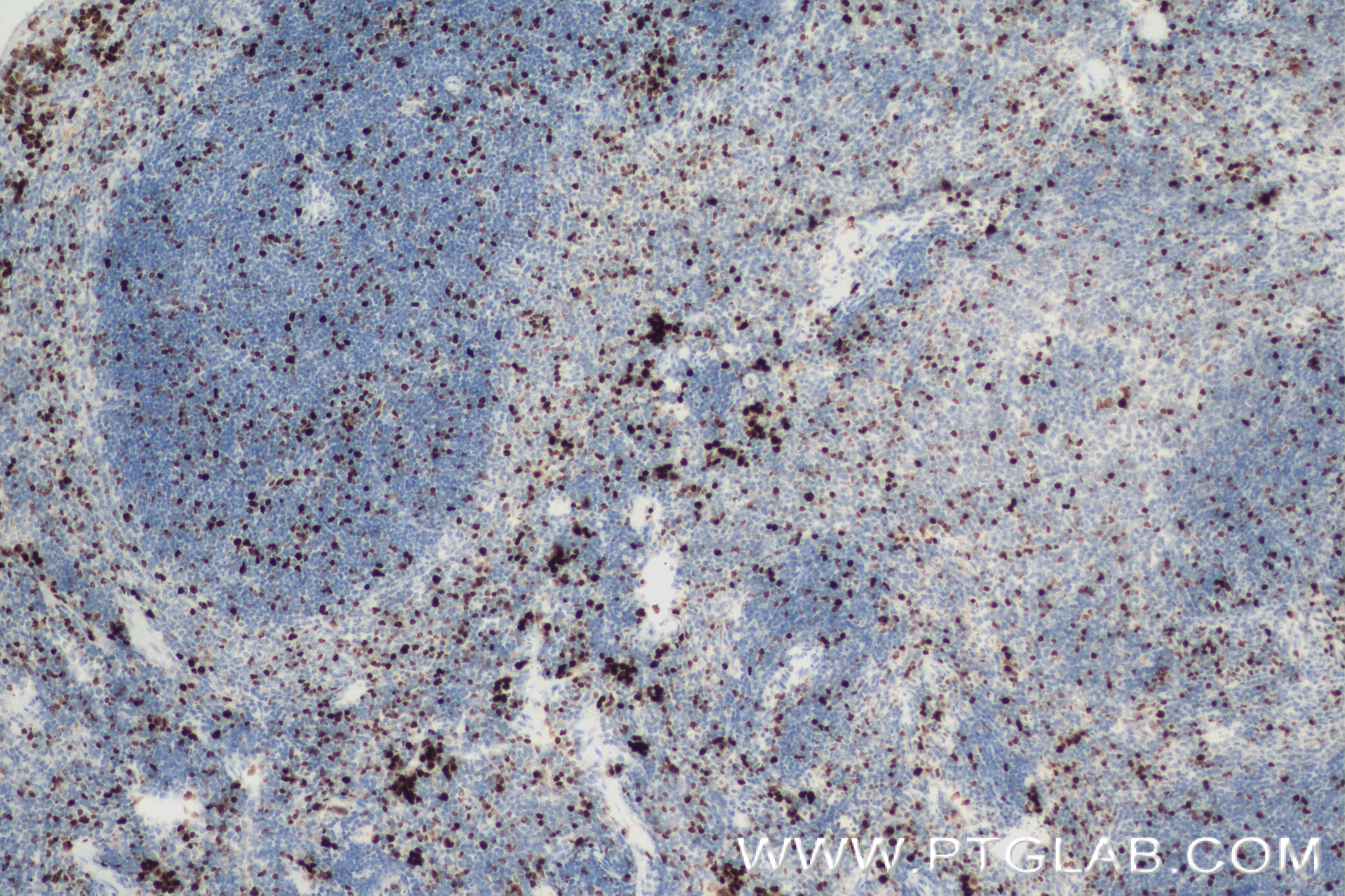 Immunohistochemistry (IHC) staining of mouse spleen tissue using Ki-67 Recombinant antibody (84432-1-RR)