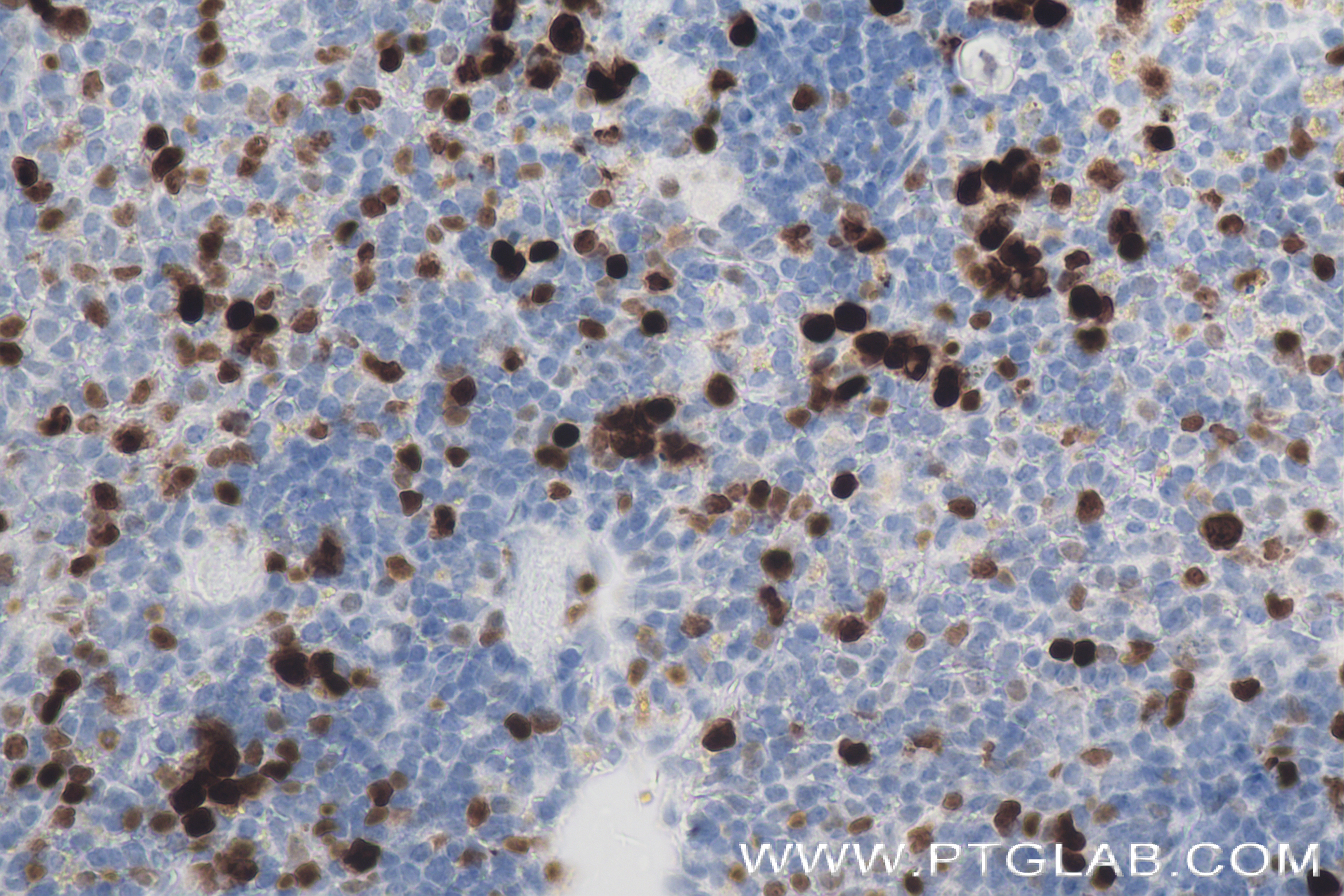 Immunohistochemistry (IHC) staining of mouse spleen tissue using Ki-67 Recombinant antibody (84432-1-RR)