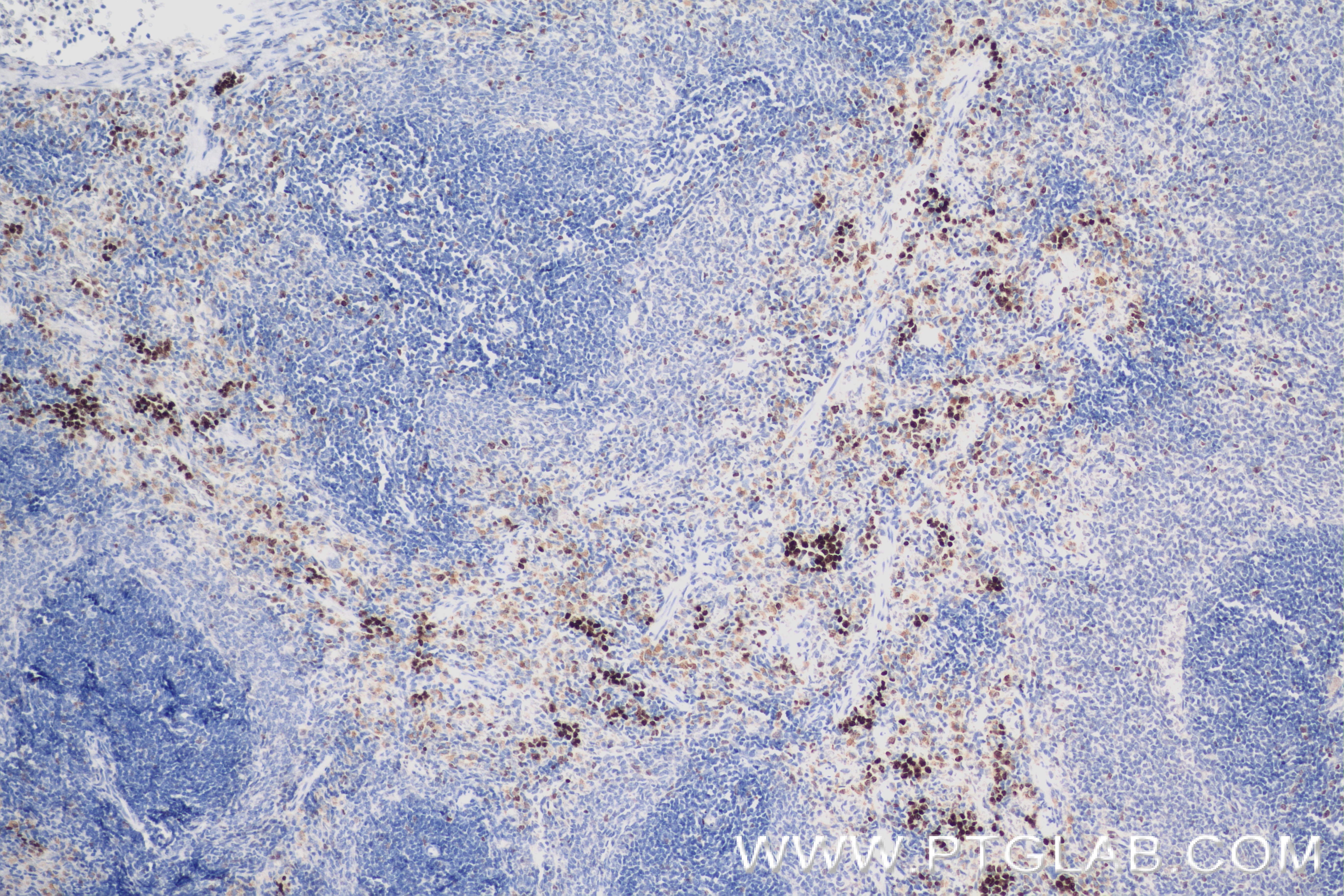 Immunohistochemistry (IHC) staining of rat spleen tissue using Ki-67 Recombinant antibody (84432-1-RR)