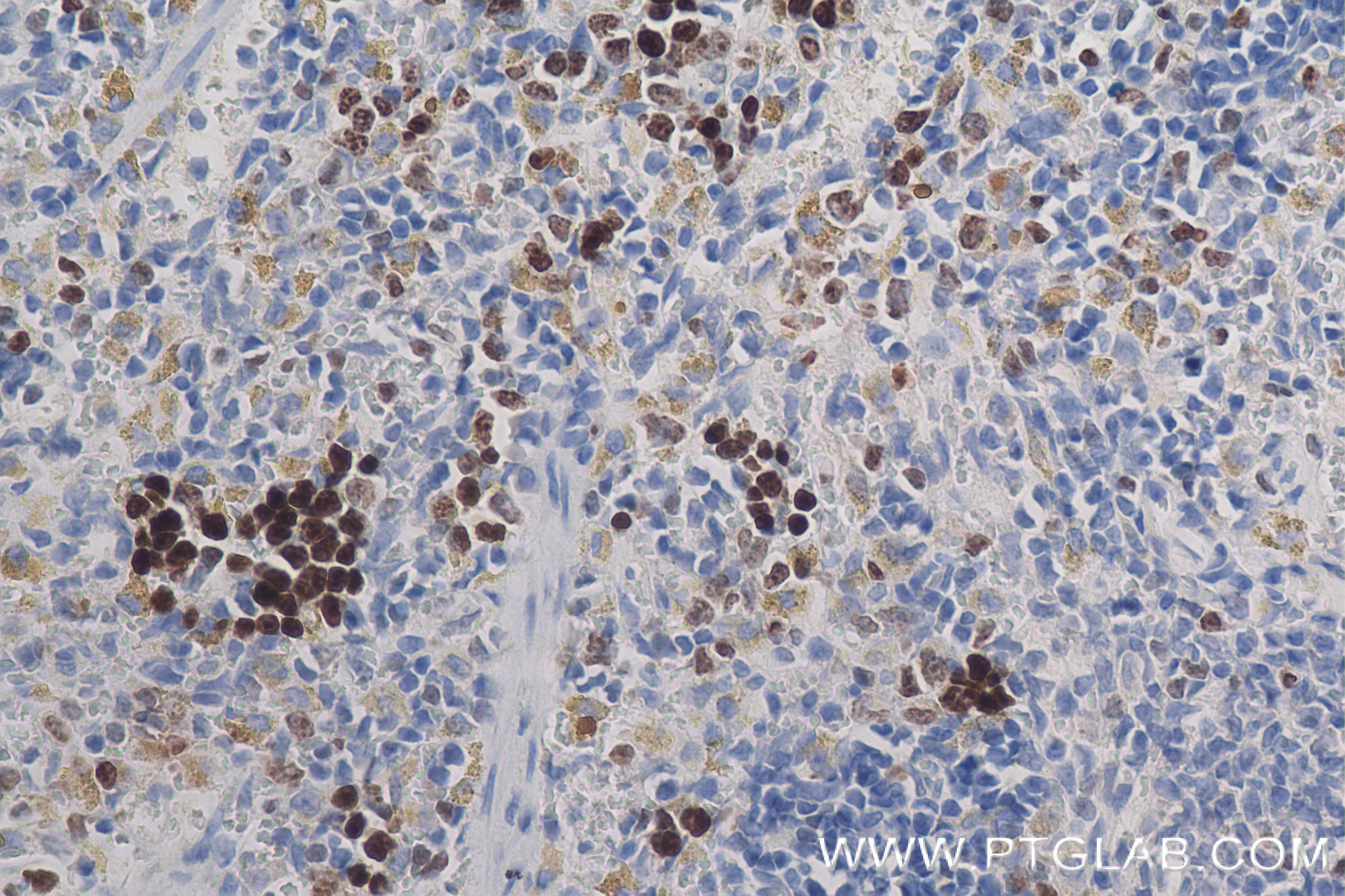 Immunohistochemistry (IHC) staining of rat spleen tissue using Ki-67 Recombinant antibody (84432-1-RR)