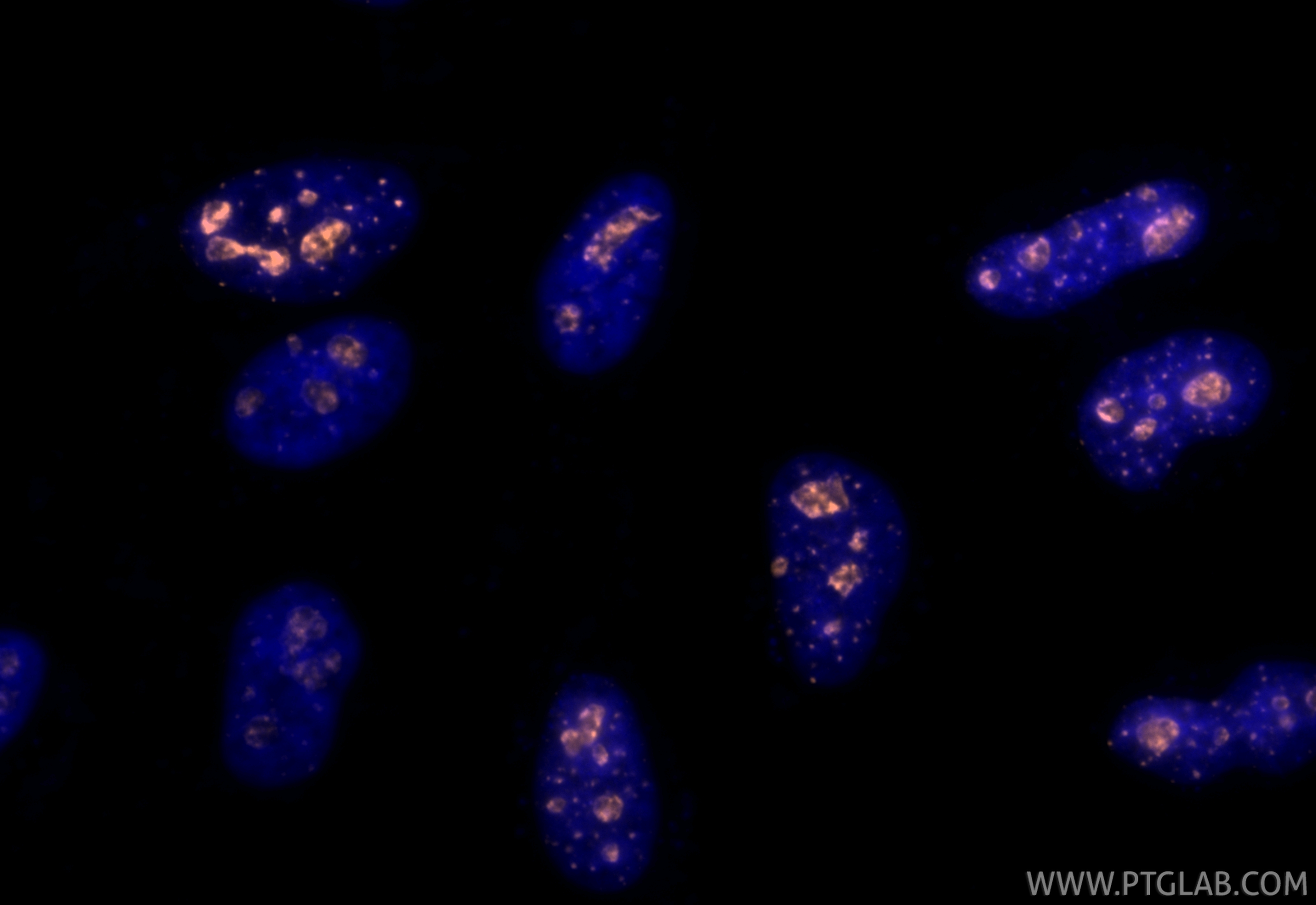 Immunofluorescence (IF) / fluorescent staining of HeLa cells using CoraLite® Plus 555-conjugated Ki-67 Recombinant an (CL555-84192-4)