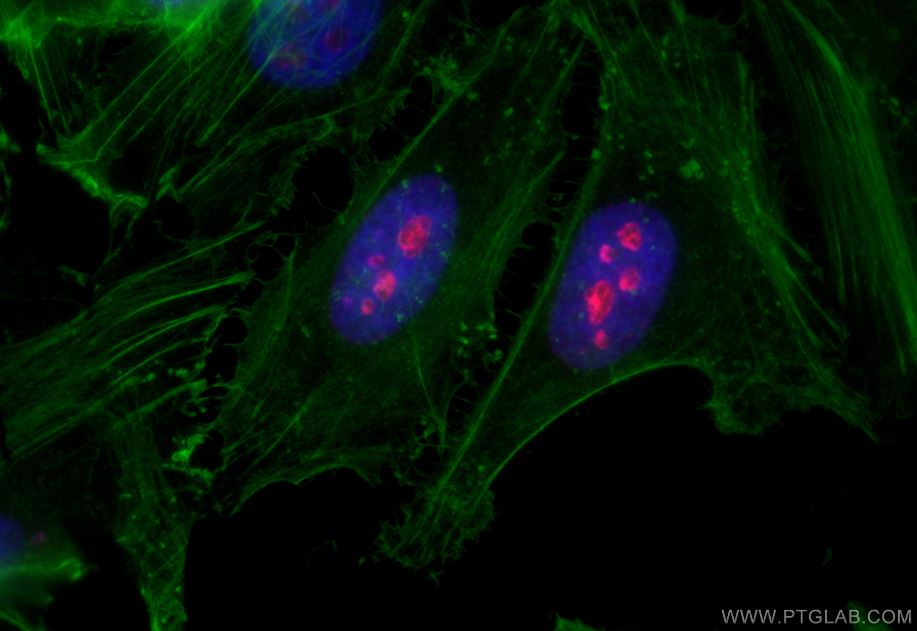 Immunofluorescence (IF) / fluorescent staining of HeLa cells using CoraLite®594-conjugated Ki-67 Recombinant antibody (CL594-84192-4)