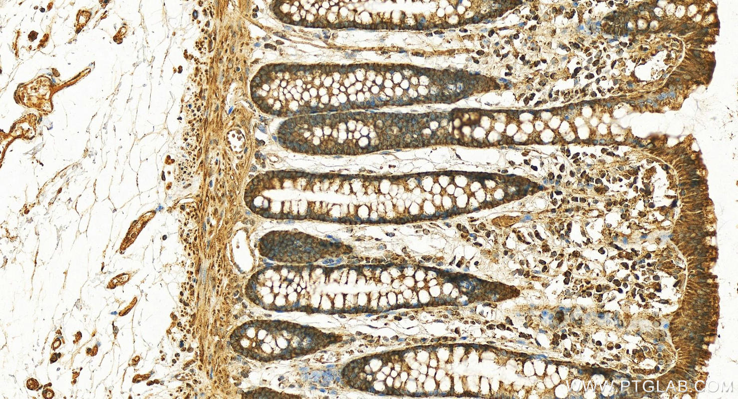 Immunohistochemistry (IHC) staining of human normal colon using Kindlin 2 Polyclonal antibody (29911-1-AP)