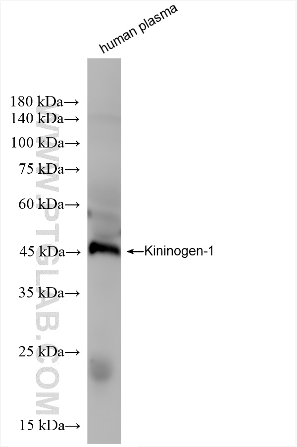 Western Blot (WB) analysis of human plasma using Kininogen-1 Recombinant antibody (84175-5-RR)