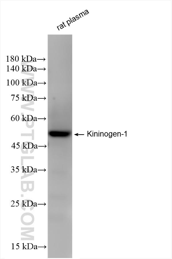 Western Blot (WB) analysis of rat plasma using Kininogen-1 Recombinant antibody (84175-5-RR)