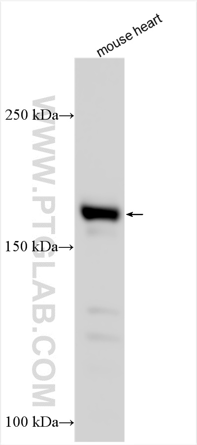 Western Blot (WB) analysis of various lysates using CACNA1C Polyclonal antibody (21774-1-AP)