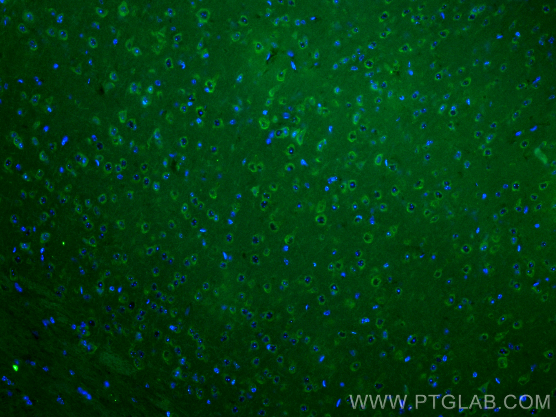 Immunofluorescence (IF) / fluorescent staining of mouse brain tissue using CoraLite® Plus 488-conjugated L-VOCC Polyclonal an (CL488-21774)