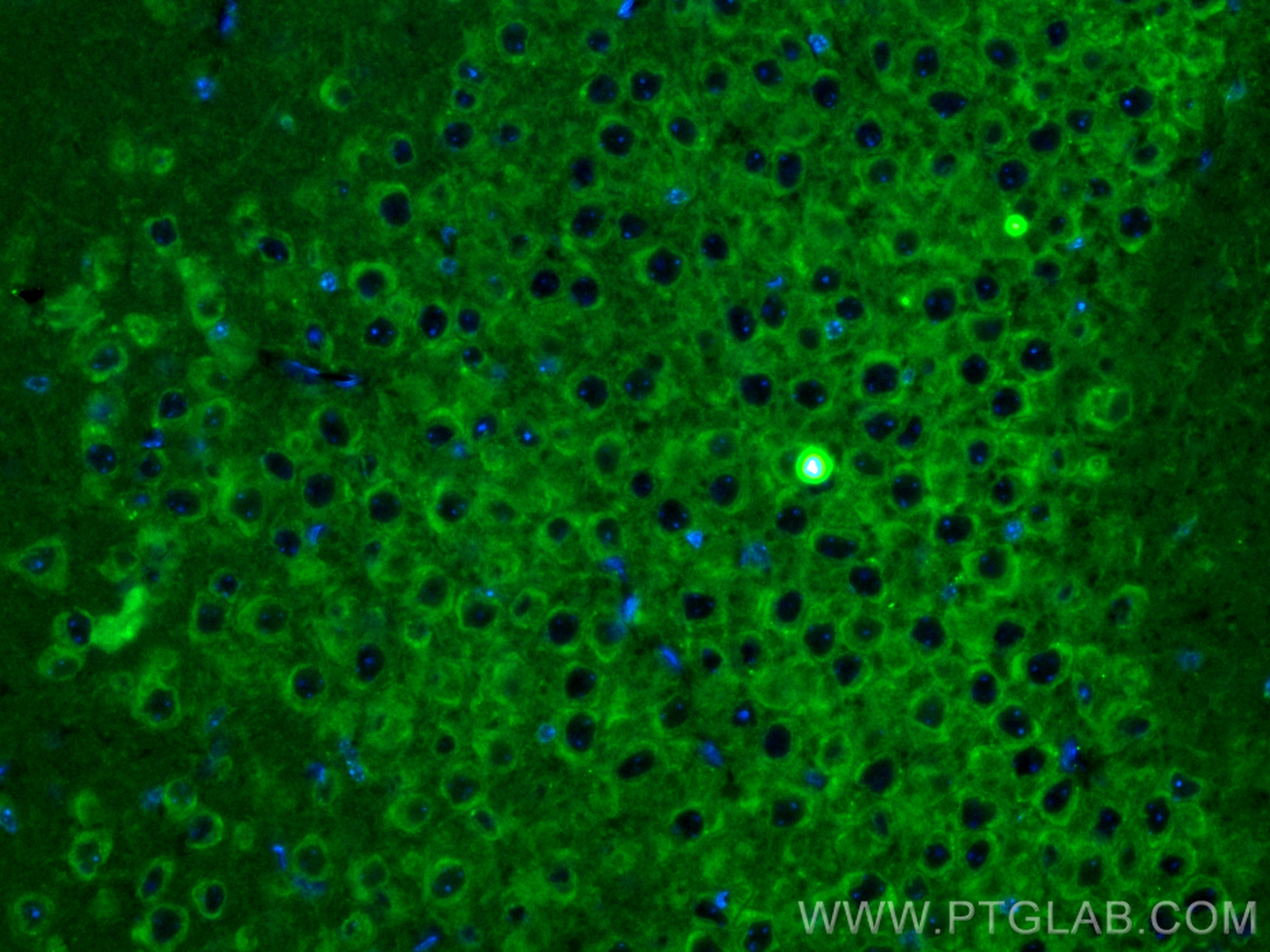 Immunofluorescence (IF) / fluorescent staining of mouse brain tissue using CoraLite® Plus 488-conjugated L-VOCC Polyclonal an (CL488-21774)