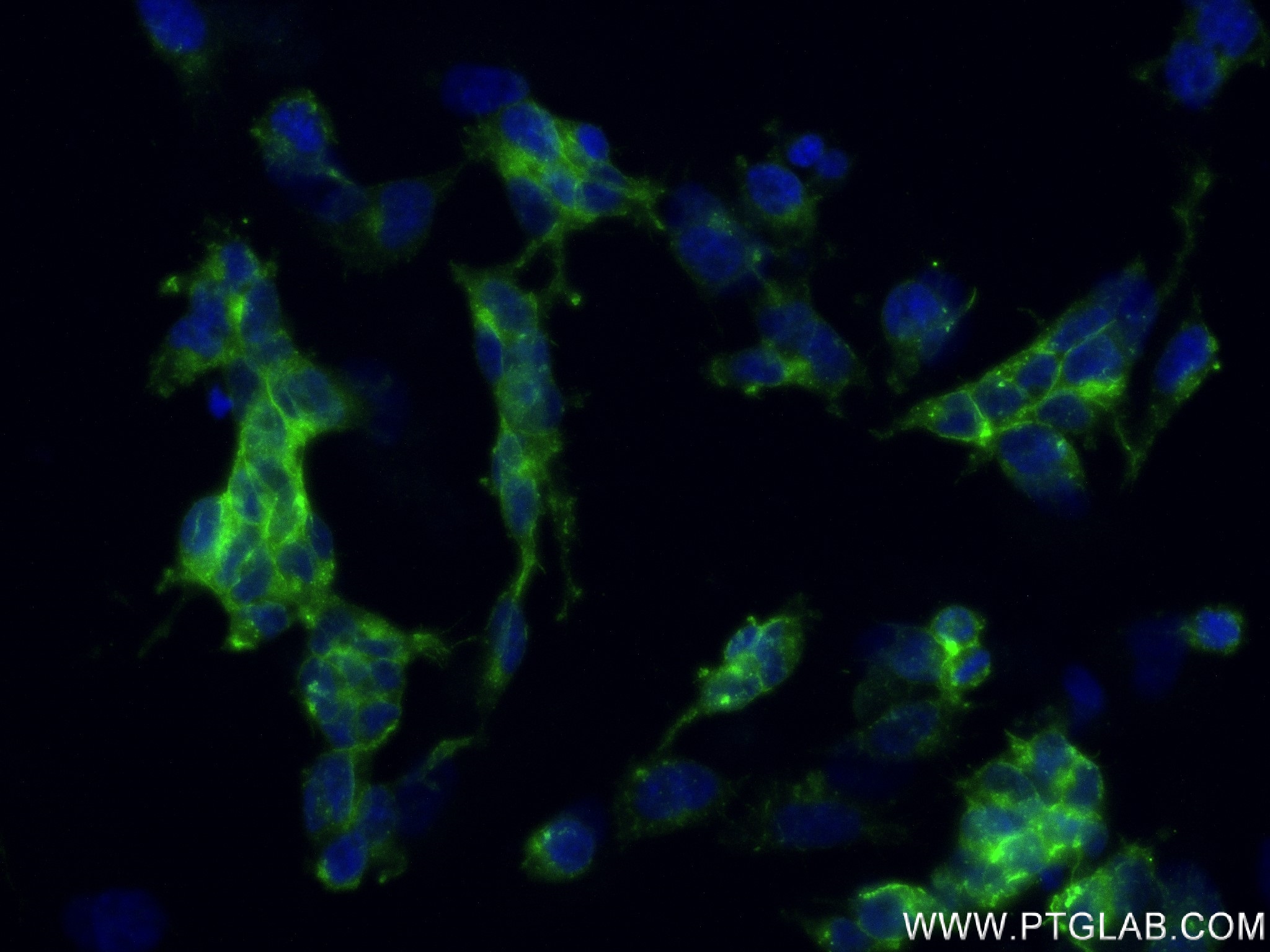 Immunofluorescence (IF) / fluorescent staining of SH-SY5Y cells using L1CAM Recombinant antibody (84034-5-RR)