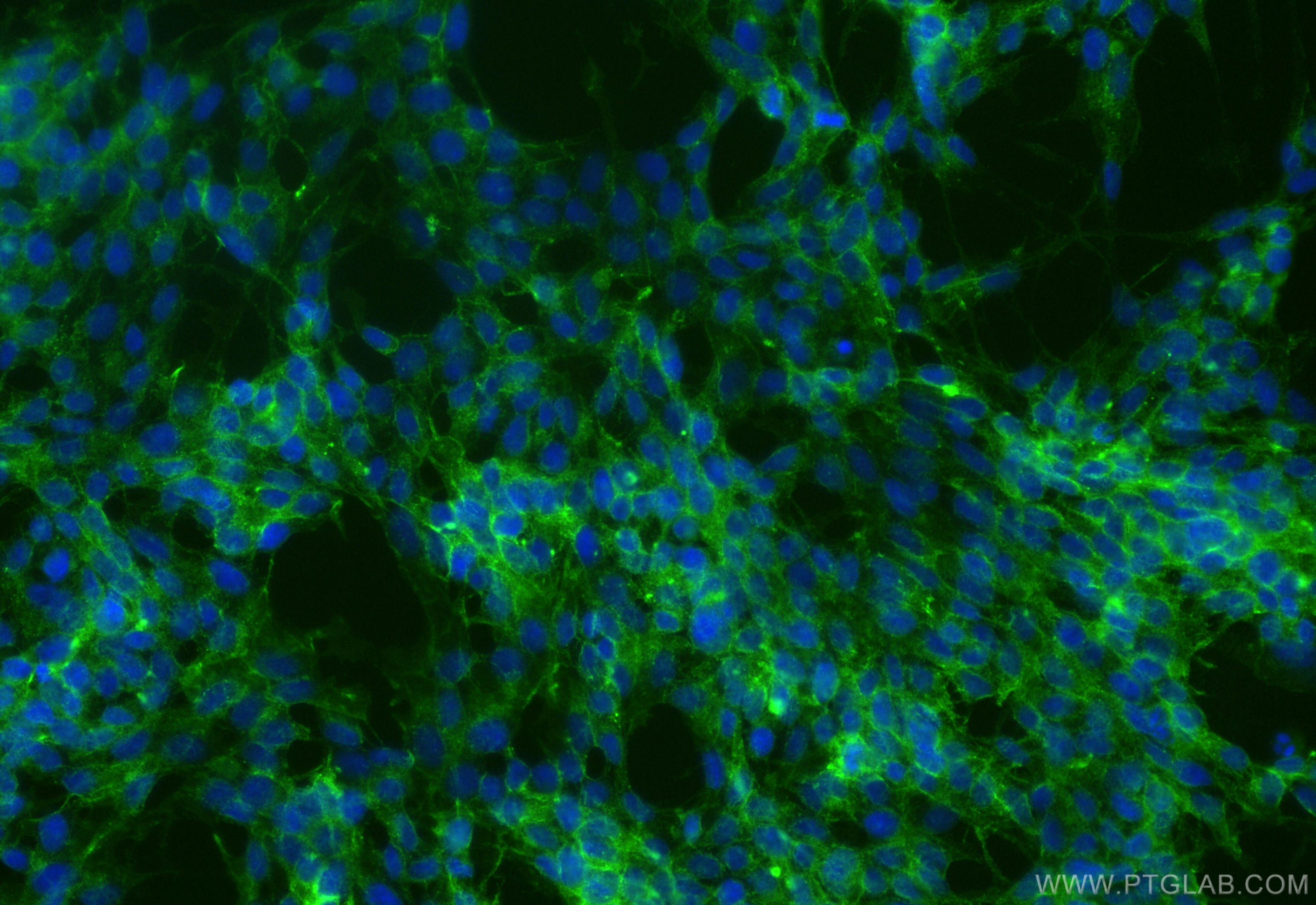 Immunofluorescence (IF) / fluorescent staining of SH-SY5Y cells using CoraLite® Plus 488-conjugated L1CAM Recombinant an (CL488-84034-5)