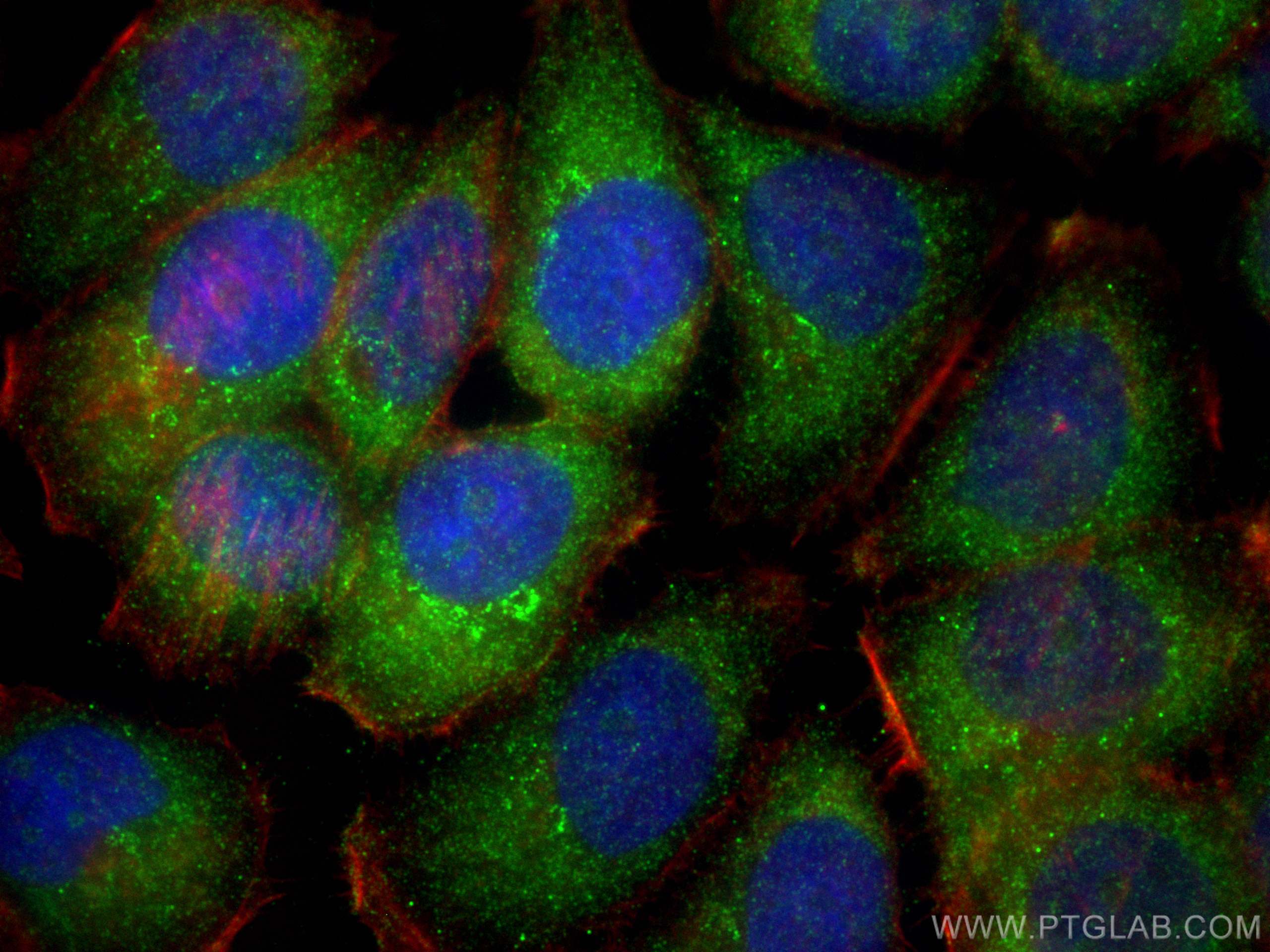 Immunofluorescence (IF) / fluorescent staining of NCCIT cells using L1TD1 Polyclonal antibody (21528-1-AP)