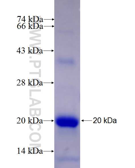 L3MBTL3 fusion protein Ag27109 SDS-PAGE