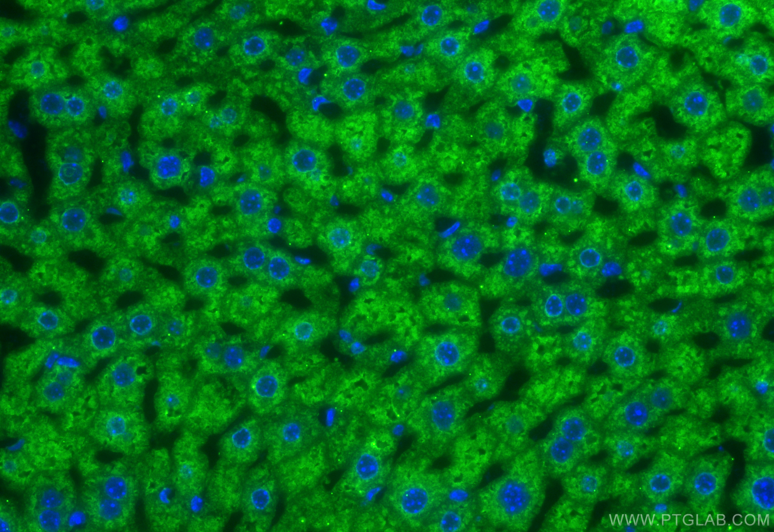 Immunofluorescence (IF) / fluorescent staining of mouse liver tissue using LACTB2 Monoclonal antibody (67399-1-Ig)