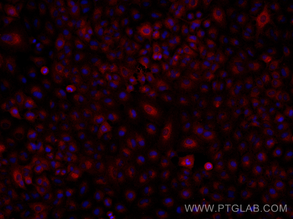 Immunofluorescence (IF) / fluorescent staining of A549 cells using LACTB2 Monoclonal antibody (67399-1-Ig)