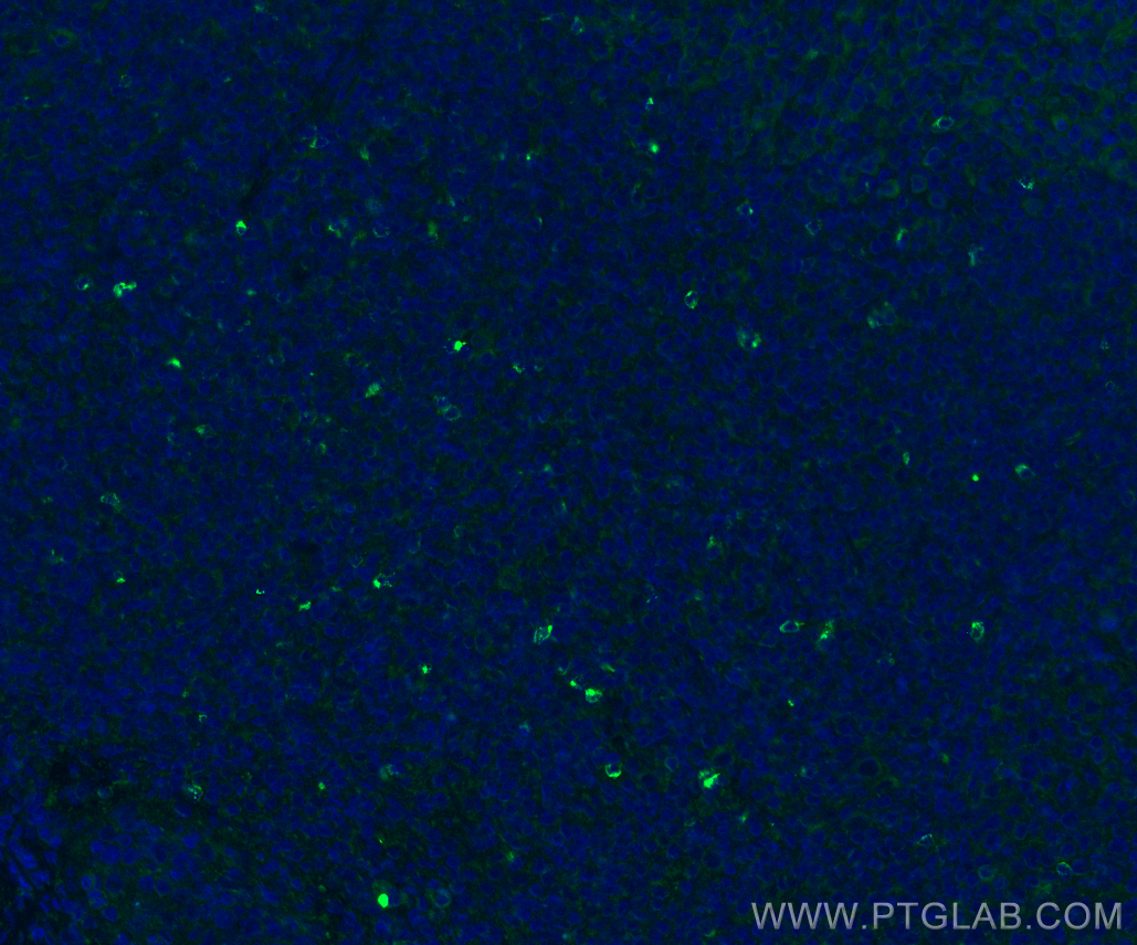 Immunofluorescence (IF) / fluorescent staining of human tonsillitis tissue using LAG-3/CD223 Polyclonal antibody (29548-1-AP)