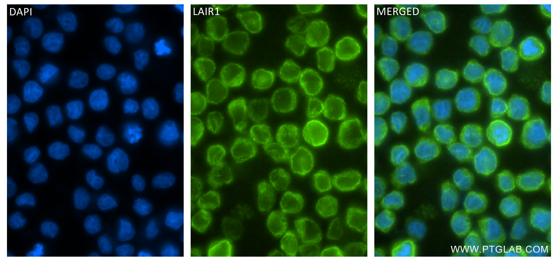 Immunofluorescence (IF) / fluorescent staining of THP-1 cells using LAIR1 Recombinant antibody (84677-4-RR)