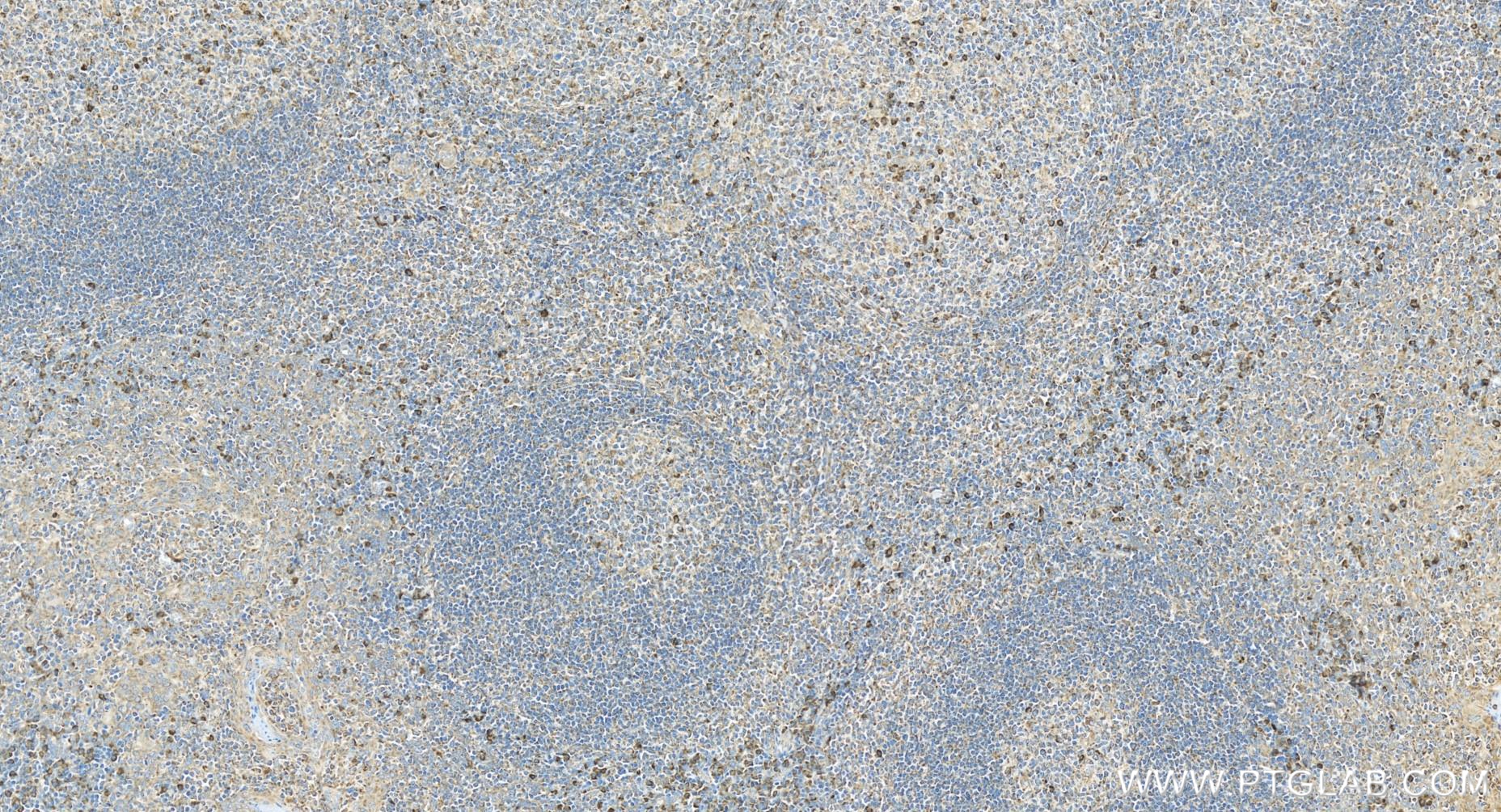 Immunohistochemistry (IHC) staining of human tonsillitis tissue using LAIR1 Recombinant antibody (84677-4-RR)