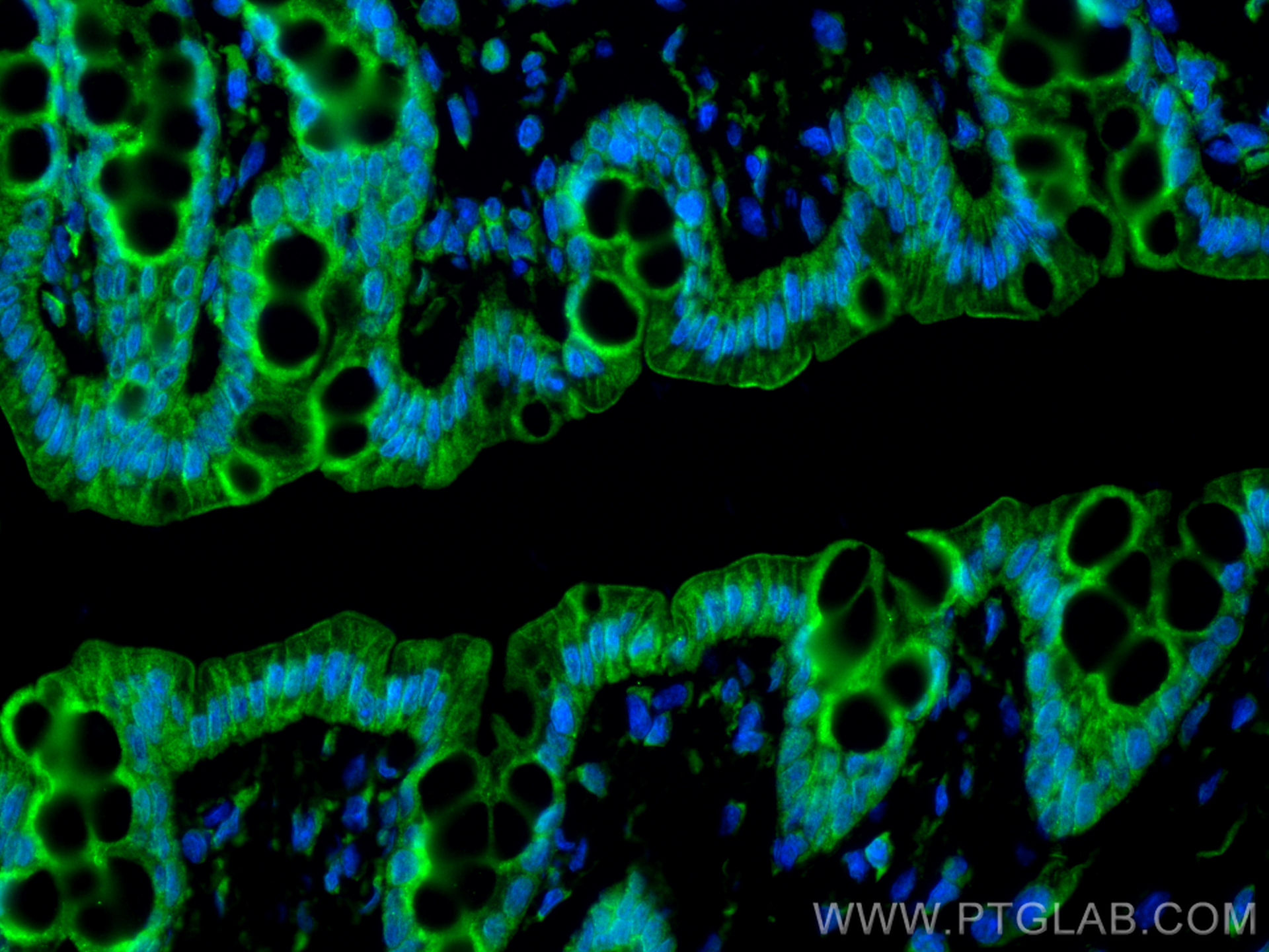 Immunofluorescence (IF) / fluorescent staining of rat colon tissue using LAMA1 Polyclonal antibody (28697-1-AP)