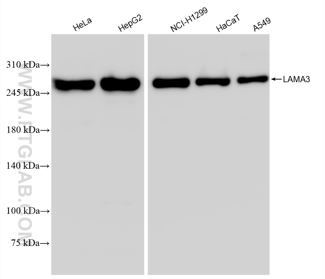 Western Blot (WB) analysis of various lysates using LAMA3 Recombinant antibody (83210-2-RR)