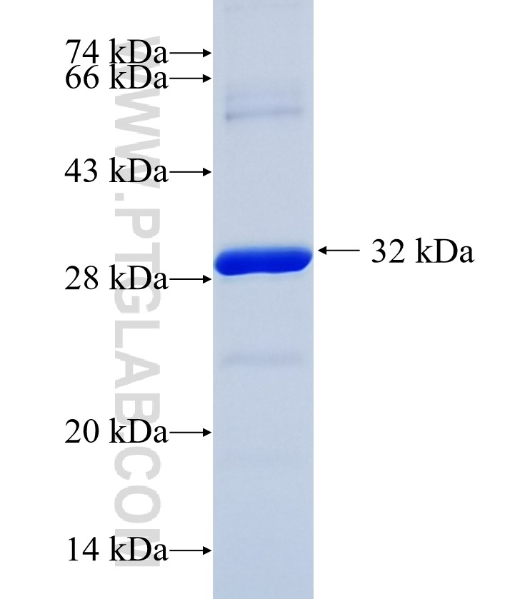 LAMA4 fusion protein Ag35773 SDS-PAGE