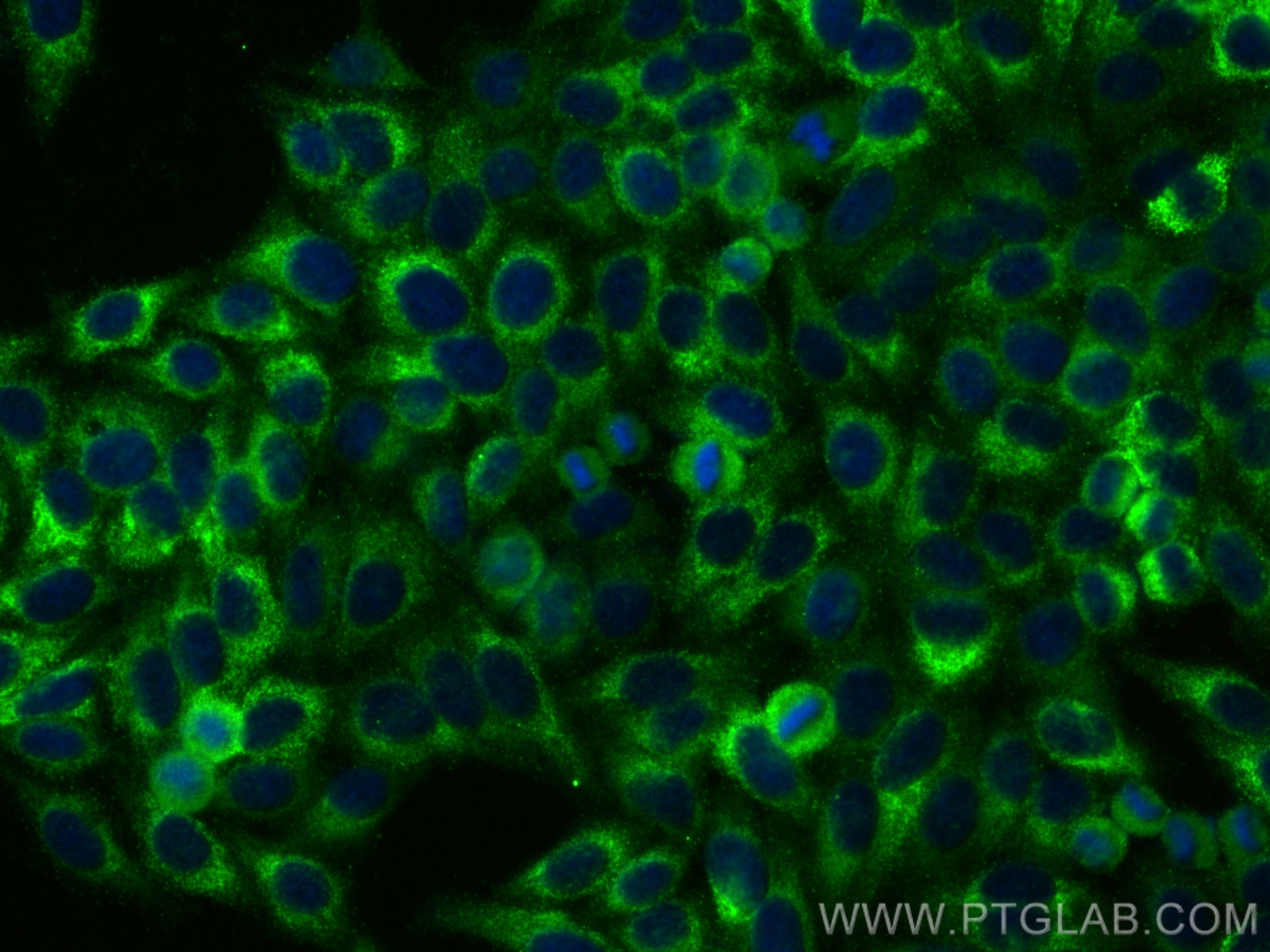 Immunofluorescence (IF) / fluorescent staining of HepG2 cells using Laminin beta 1 Polyclonal antibody (23498-1-AP)